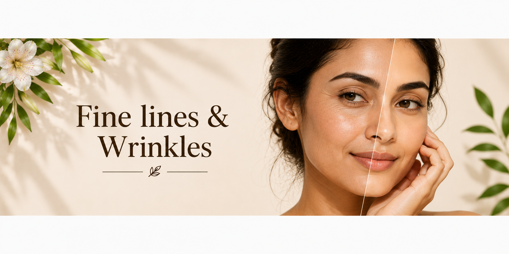 Fine Lines & Wrinkles n